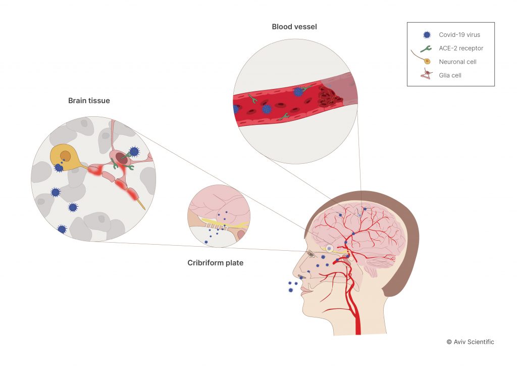 Long Covid Impact On Brain.