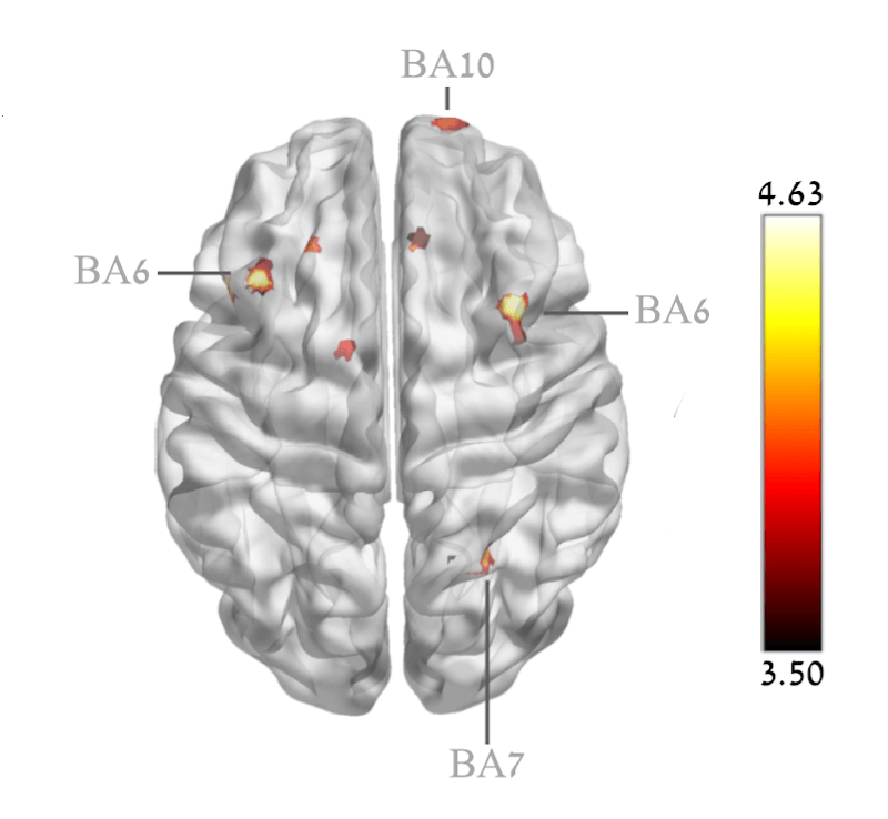 HBOT_Cognition_Shai-Efrati