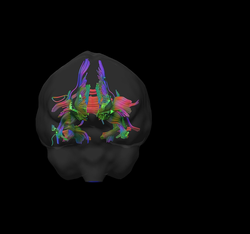 image of The First Long COVID Treatment Backed by Clinical Trials